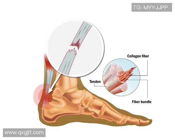 足球明星跟腱断裂的案例分析与影响探讨 足球明星跟腱断裂的案例分析与影响探讨
